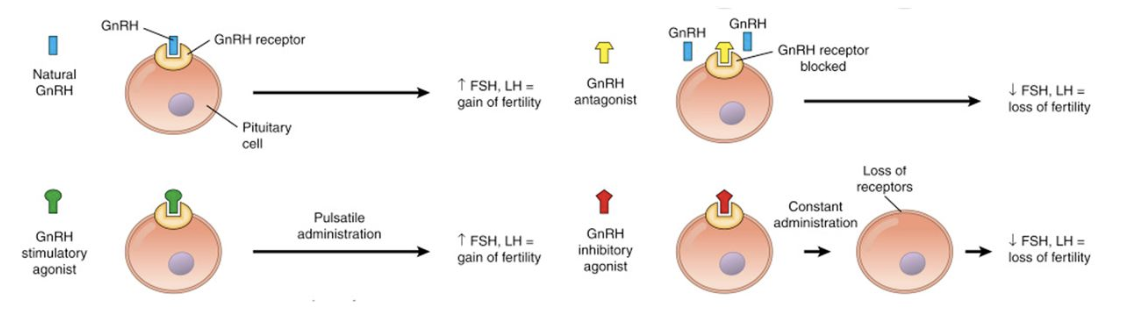 <p>Why does a continuous dose of GnRH agonist block steroid hormone expression in controlled ovarian hyperstimulation?</p><p>A.	High blood GnRH agonist concentration blocks LH activity in the ovaries.</p><p><strong>B.	Continuous GnRH activation triggers GnRH receptors degradation</strong></p><p>C.	GnRH agonists inhibit gonadotropin activity.</p><p>D.	Continuous GnRH agonist administration shrinks the ovaries.</p><p></p><p>Pulsatile GnRH increases fertility, as it can lead to hormone surges and increase in steroidogenesis. By providing a continuous dose of hormones, you downregulate the amount of receptors that are available to respond to FSH and LH </p>