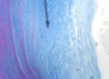 <p>what kind of cartilage is this </p>