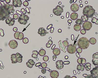 <p>Form in alkaline pH</p><p>Not clinically significant</p>