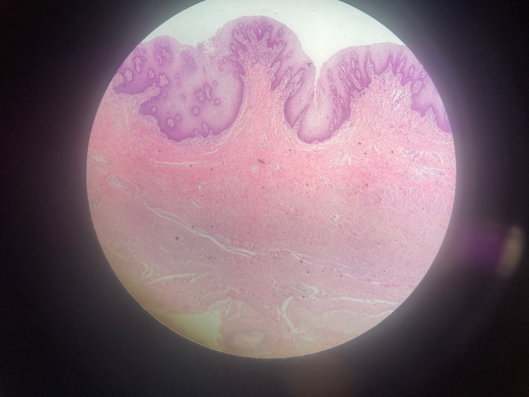 <p>Vagina (human)</p><p><span>Squamous epithelial cells</span></p><p><span>Intermediate cells</span></p><p><span>Basal cells</span></p><p><span>Langerhans cells</span></p><p><span>Goblet cells</span></p>