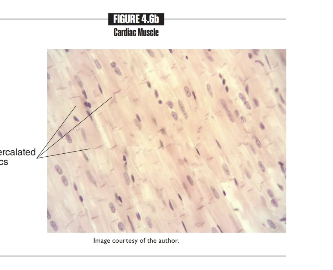 <p>Cardiac Muscle </p>