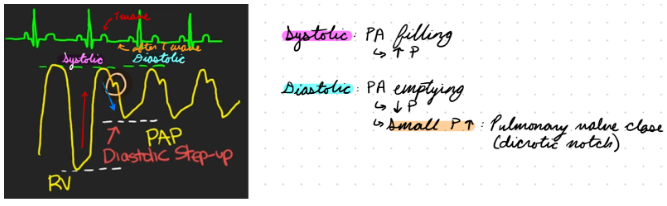 <p>Systolic Pressure: Pulmonary artery filling</p><ul><li><p>Increase pressure until same as right ventricle</p></li><li><p>During T wave</p></li></ul><p>Diastolic Pressure: Pulmonary artery emptying</p><ul><li><p>Decrease pressure</p></li><li><p>Higher than right ventricle (diastolic step-up)</p></li><li><p>Small pressure increase: Pulmonary valve closes</p><ul><li><p>Dicrotic notch</p></li><li><p>After T wave and during diastole</p></li></ul></li></ul><p></p>