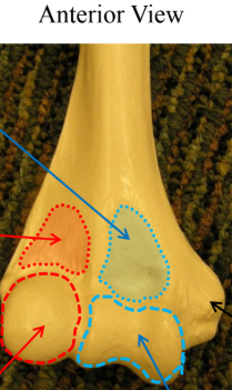 <p>What is the black arrow pointing to? </p>