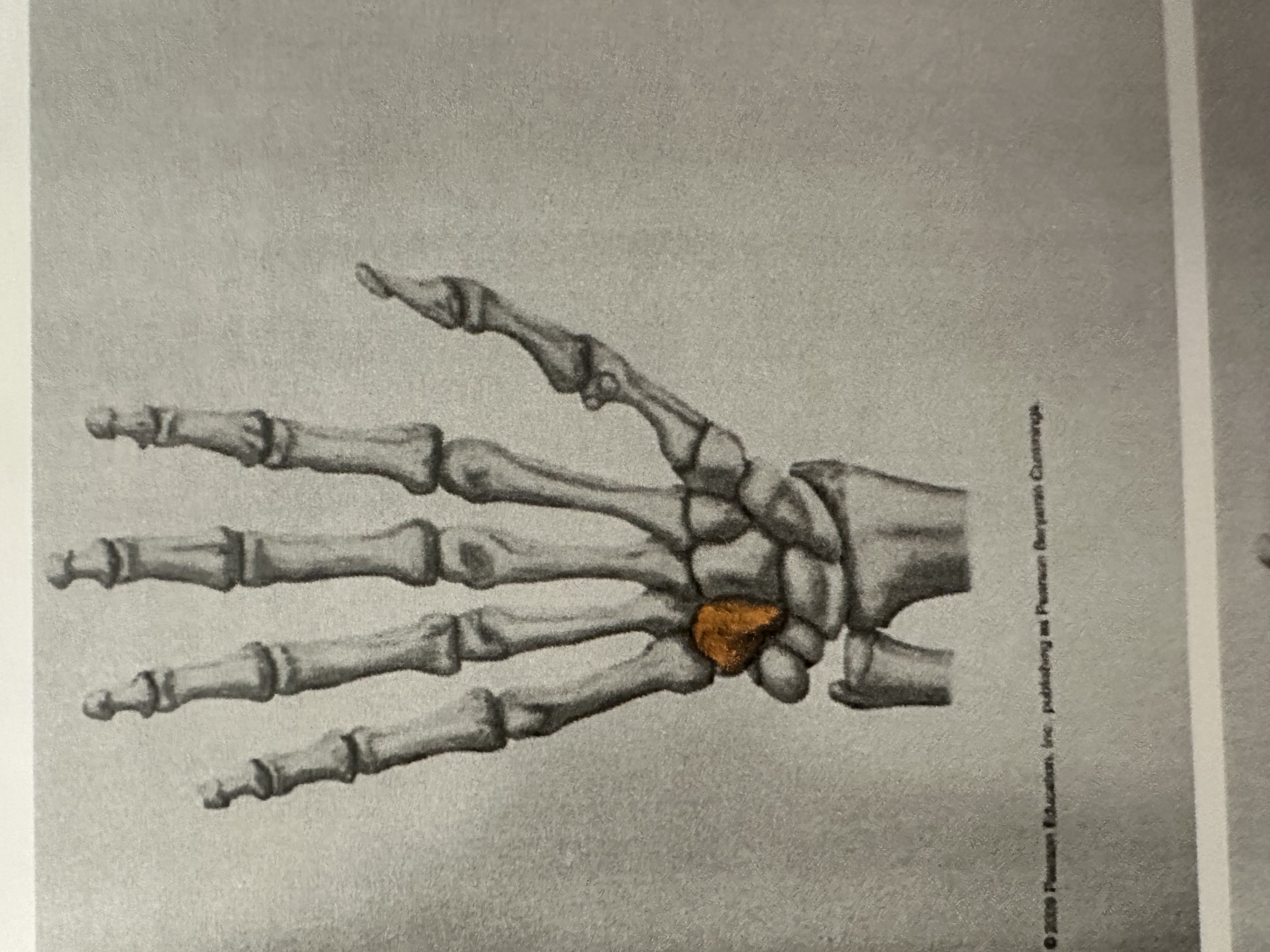<p>Distal Carpal Bone</p><p>( Here Comes The Thumb)</p>