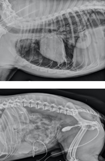 <p>Obtain a complete&nbsp;history&nbsp;and physical exam. Perform emergency management of life-threatening&nbsp;injuries first.&nbsp;<br><br>Many patients with open fractures have multiple injuries. Assess for other injuries and the neurovascular structures.<br><br>Open wounds are covered with a sterile dressing and splint to prevent further soft tissue damage and contamination; most open&nbsp;fractures are contaminated with nosocomial organisms.</p>