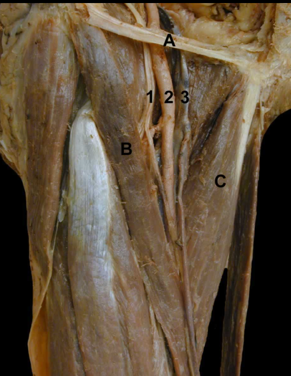 <p>C</p>