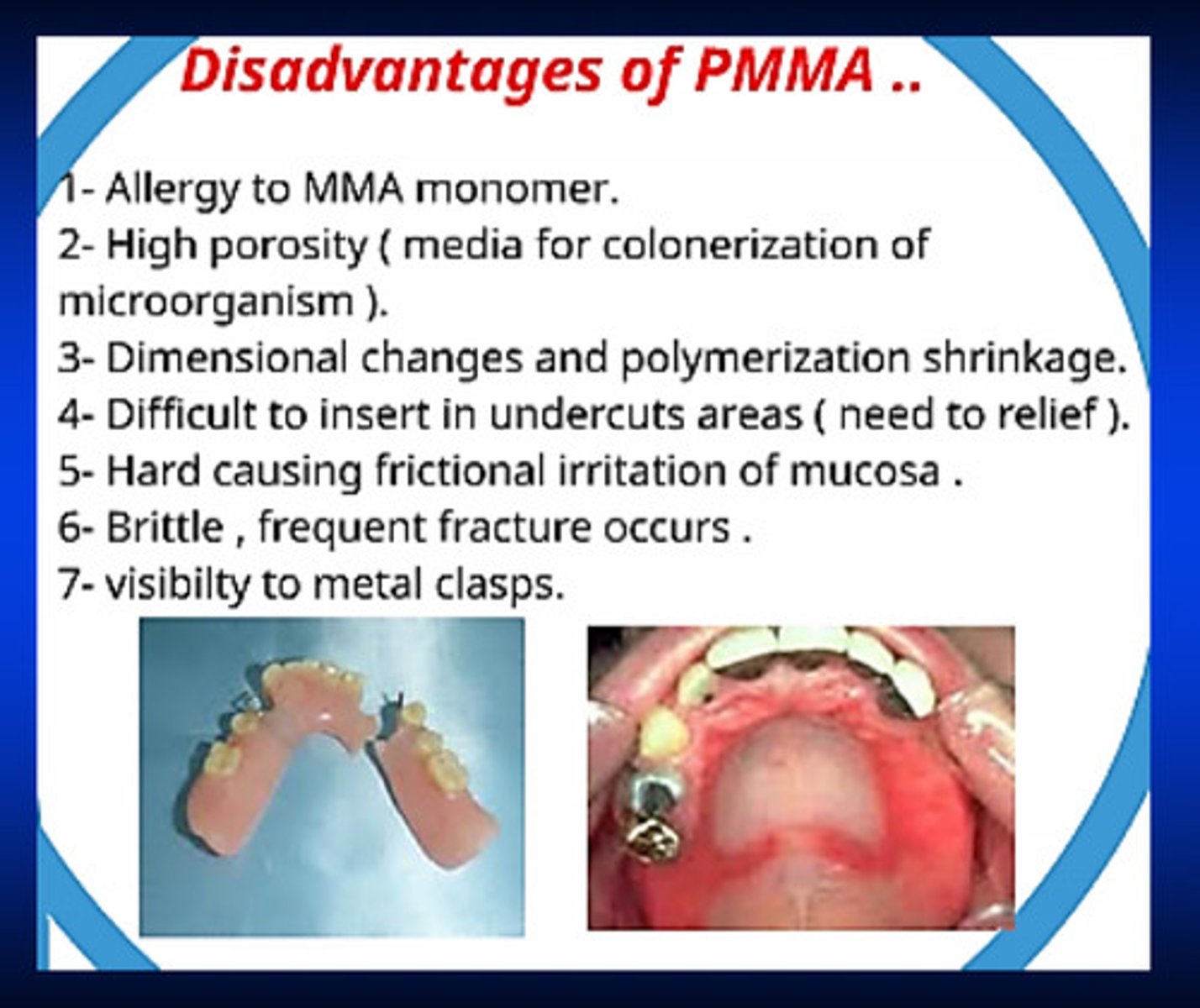 <p>1) allergies to MMA monomer</p><p>2) high porosity (microorganisms can colonize in the porosities)</p><p>3) dimensional changes and polymerization shrinkage</p><p>4) difficult to insert in undercut areas</p><p>5) hard: causes frictional irritation of mucosa</p><p>6) brittle, frequent fracture occurs</p><p>7) visibility to metal clasps</p>