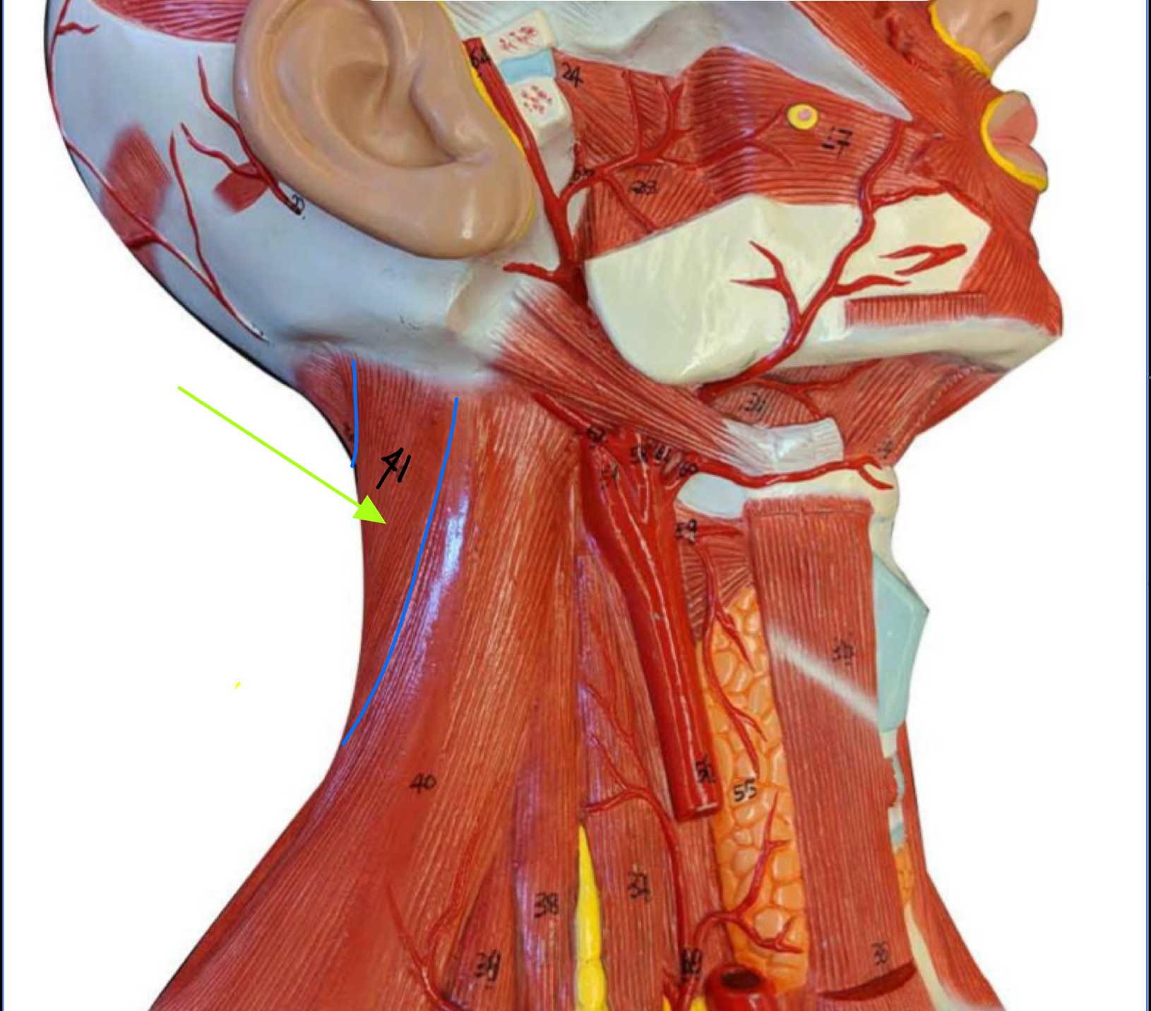 <p>What type of muscle is this ( altay model)</p>