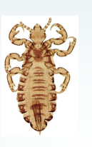 <p>Human louse-anoplura</p>