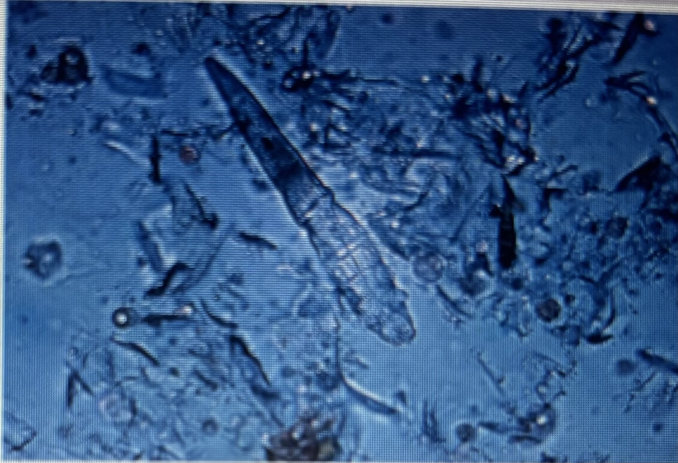 <p>Red mange/follicle mite </p><p>Host specific </p><p>Overgrowth of normal fauna of skin </p>