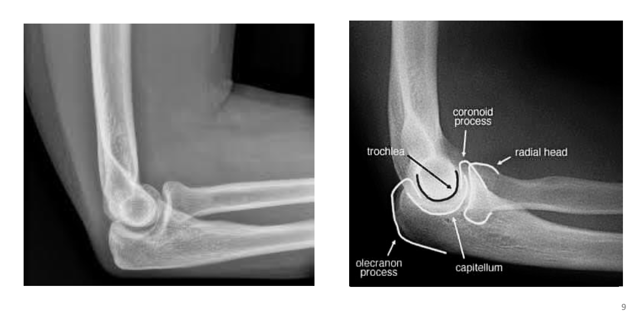 <p>Identify the structures ? view?</p>
