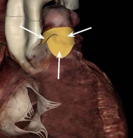 <p>What are the arrows pointing to?</p>