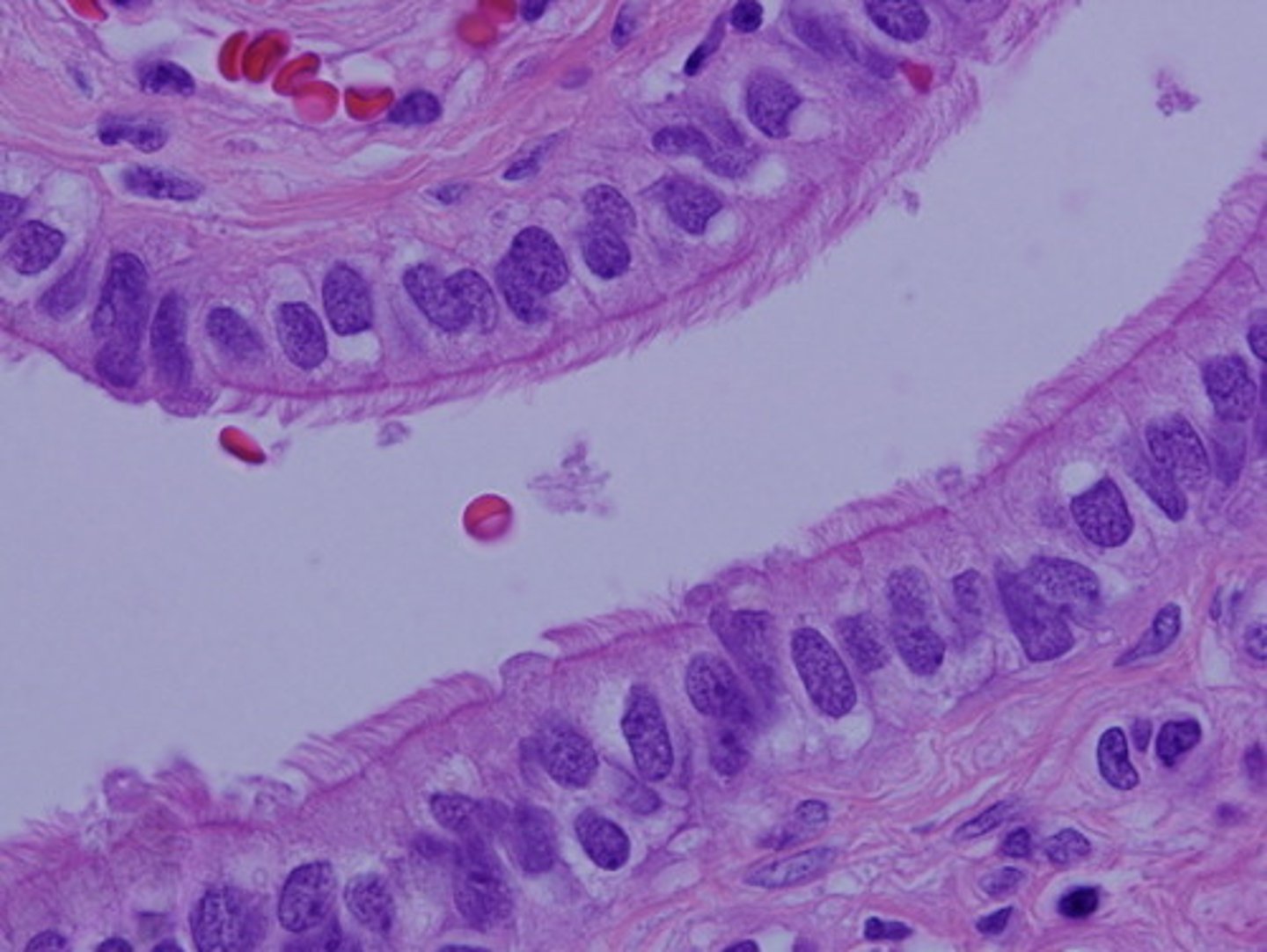 <p>Function: absorption, secretion</p><p>Location: stomach, intestine, gallbladder, uterine ducts</p>