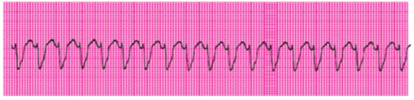 <p>Name this rhythm.</p>