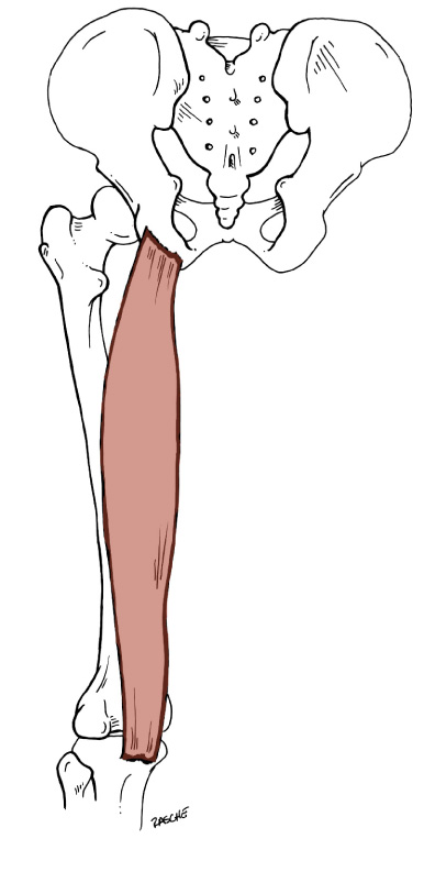 <p>Origin: <span>Upper, outer surface of the ischial tuberosity</span></p><p>Insertion: <span>Medial condyle of the Tibia</span></p><p>Action: <span>extends the thigh, flexes the leg</span></p>