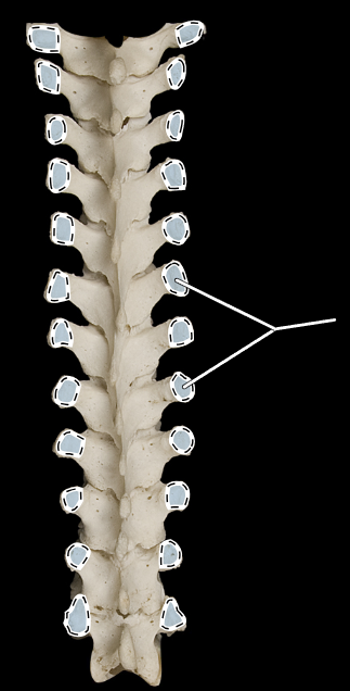 <p>What part of the vertebra is highlighted?</p><p>What region of the vertebral column is this?</p><p>(Posterior view).</p>