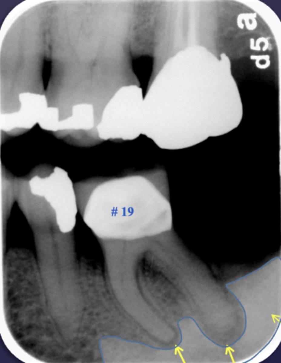 <p>What are two defects that the arrows are pointing to?</p>
