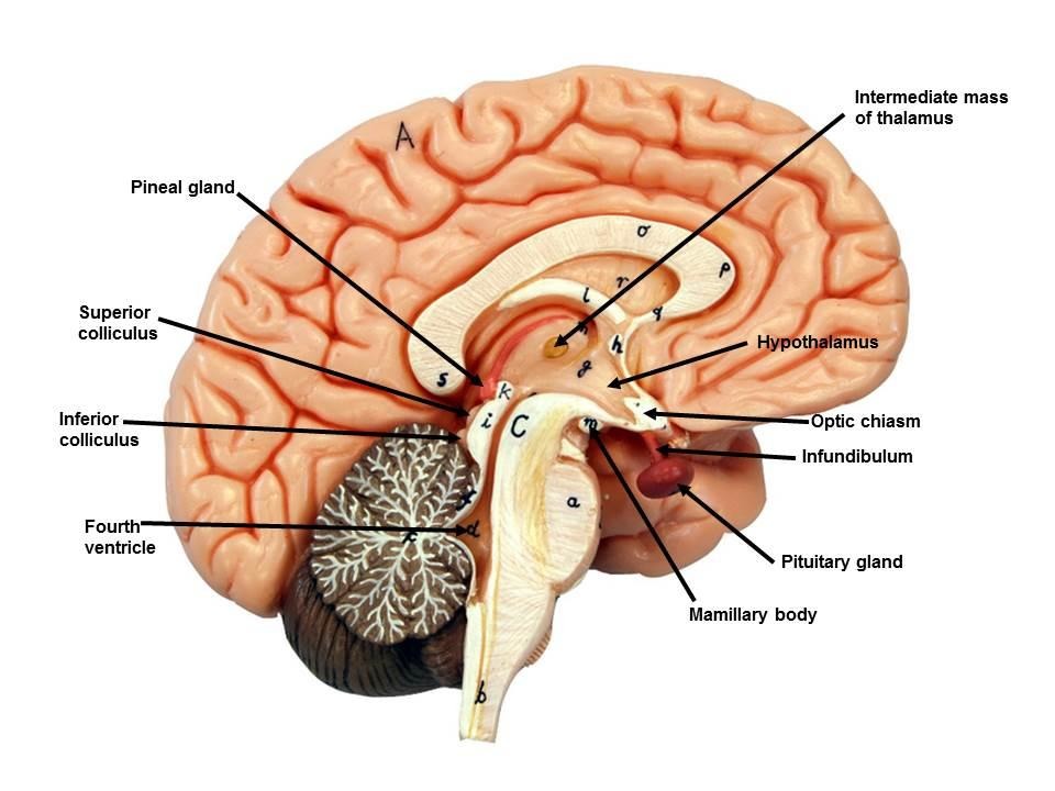 <p>connects left and right brain for thalamus</p>