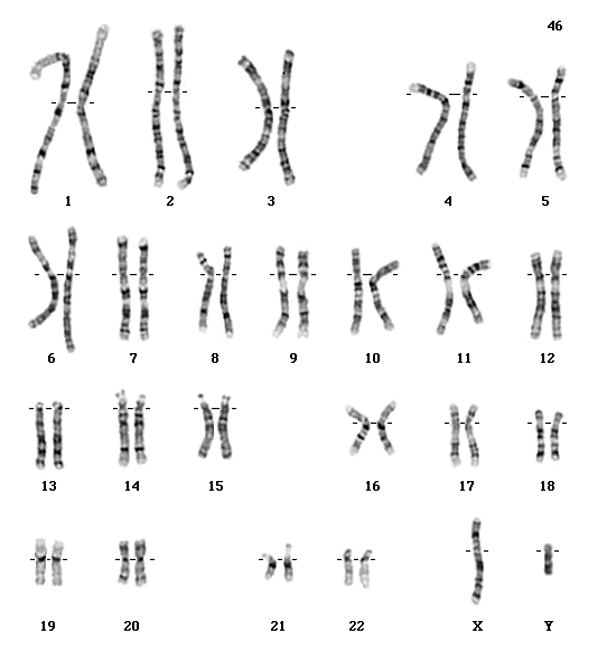 <p>An organized picture of the chromosomes of a human arranged in pairs by size from largest to smallest.</p><p>Pairs 1-22 called AUTOSOMES</p><p>Last pair are SEX CHROMOSOMES</p><p></p>