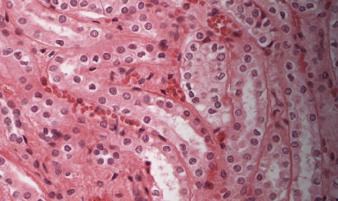 <p>Where can you see this type of epithelium?</p>