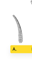 <p>Type of Forcep</p>