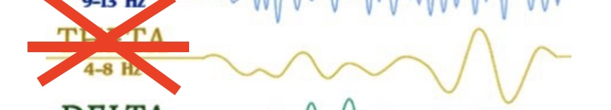 <p>What brain wave is this? Where is it present? What can it mean in adults? </p>