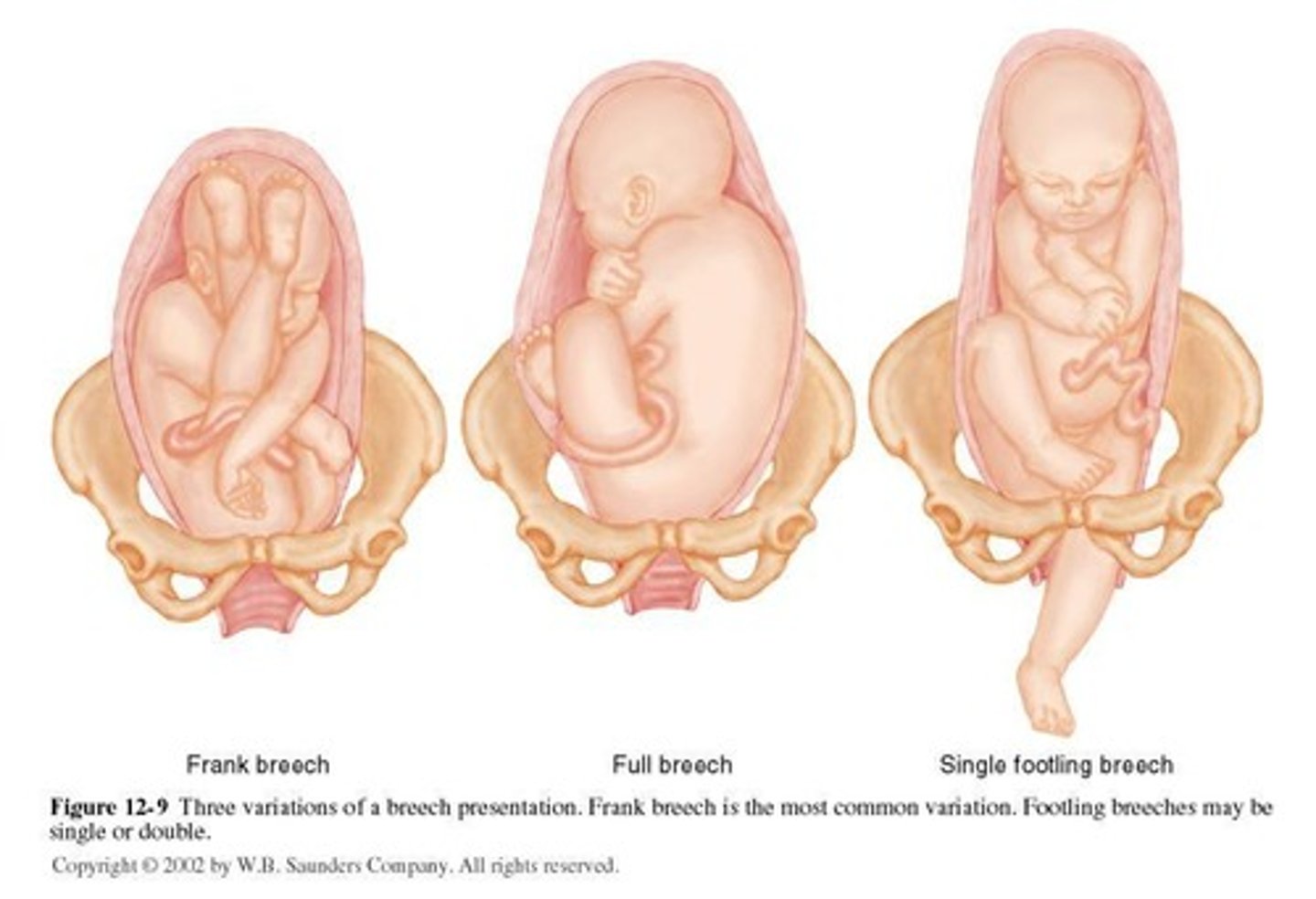 <p>The process by which the fetus is expelled from the mother's body.</p>