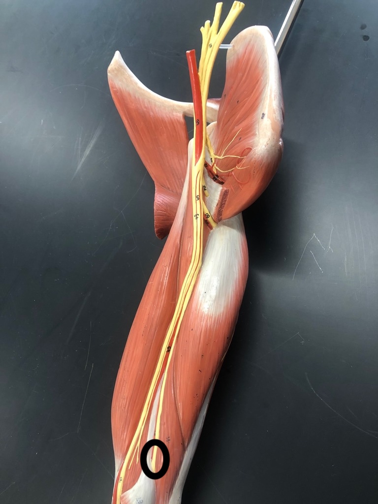 <p>What muscle is this?*****</p>