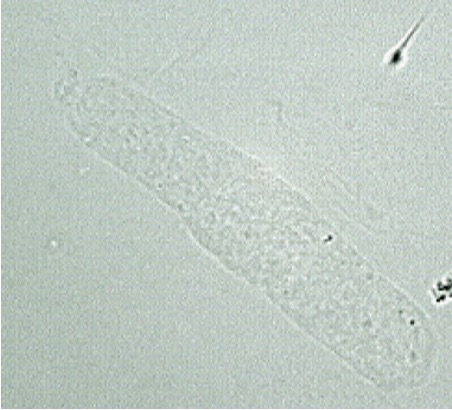 <p>Hyaline casts examination</p>