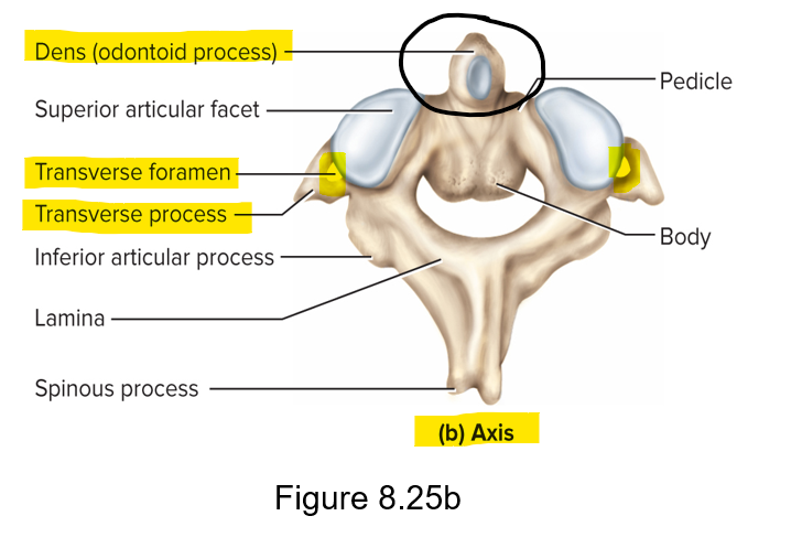 <p>C2 - allows head rotation for saying “no”; dens/odontoid process </p>