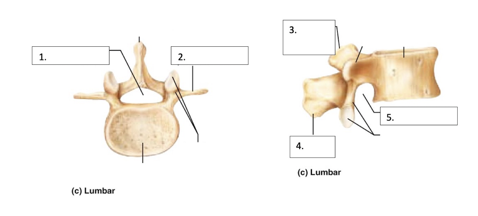 <p>Vertebral Foramen</p>