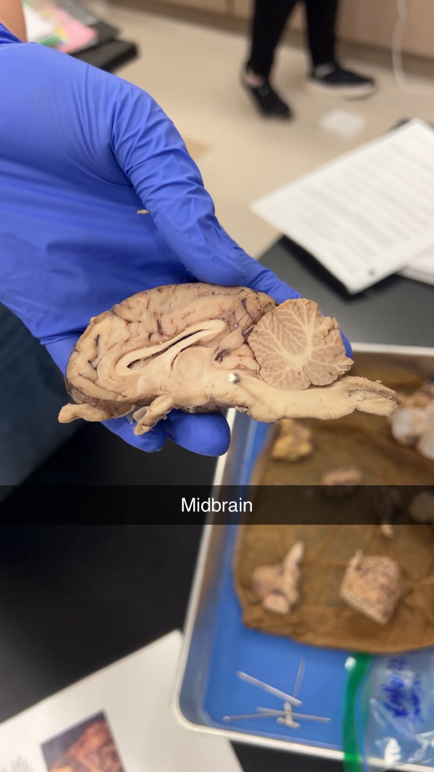 <p>midbrain</p>
