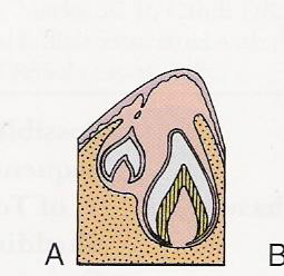 <p>Lingual to the incisal level of the forming primary teeth</p>