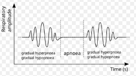 <p>Breaths gradually become deeper, then become shallow, and are then followed by periods of apnea that repeat in this cycle</p><p></p><p>Cause: Brain injury (inter cranial pressure (ICP)) or neurological dysfunction </p><p></p><p>Shallow → deeper → deepest → shallower → pause → repeat</p>