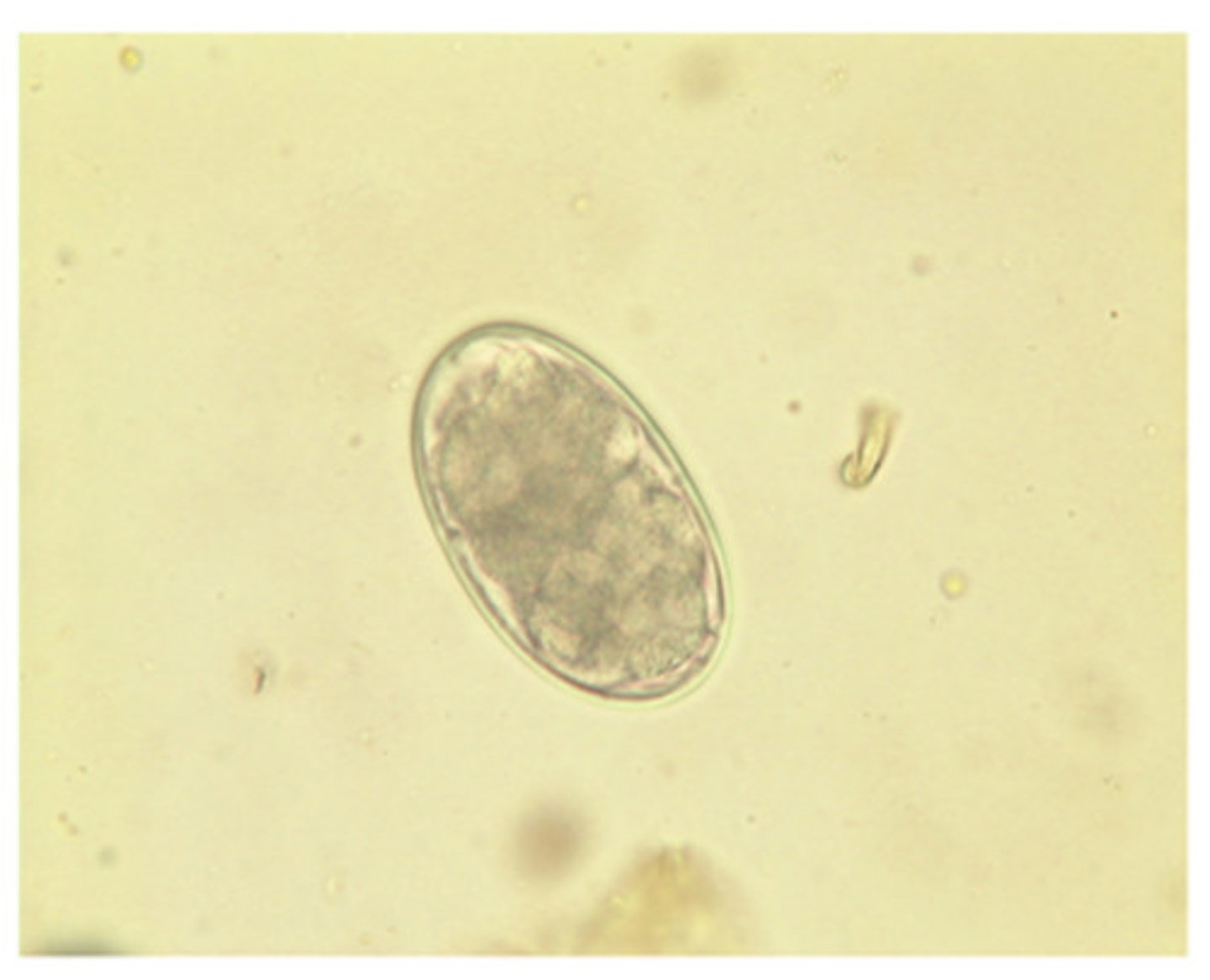 <p>When this nematode-type egg is found on a fecal flotation of a ruminant fecal specimen, it should be reported as:</p>