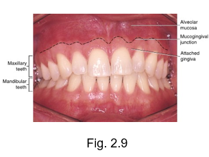 <ul><li><p>reddish-pink tissue with blue vascular areas</p></li><li><p>shiny, moist region which is extremely mobile (allows you to stretch lips) and lines the vestibules of the oral cavity</p></li><li><p>lining mucosa</p></li></ul><p></p>