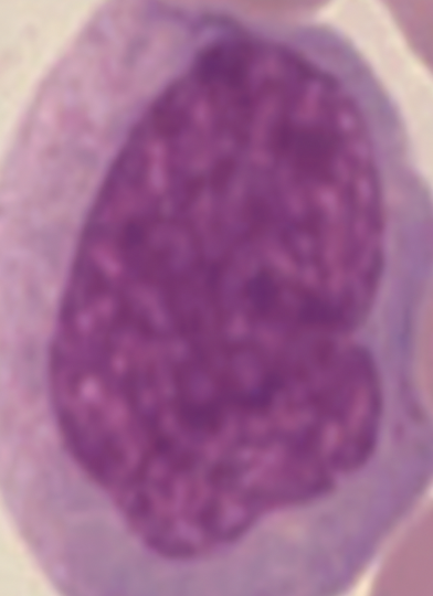 <p><span style="color: purple;"><strong><em><span>Formed Element:</span></em></strong></span><strong> Monocyte (leukocyte)</strong></p>