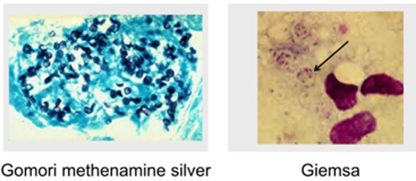 <p>· Serology, nucleic acid detection not useful</p><p>· Cyst wall, intracystic body stains</p>