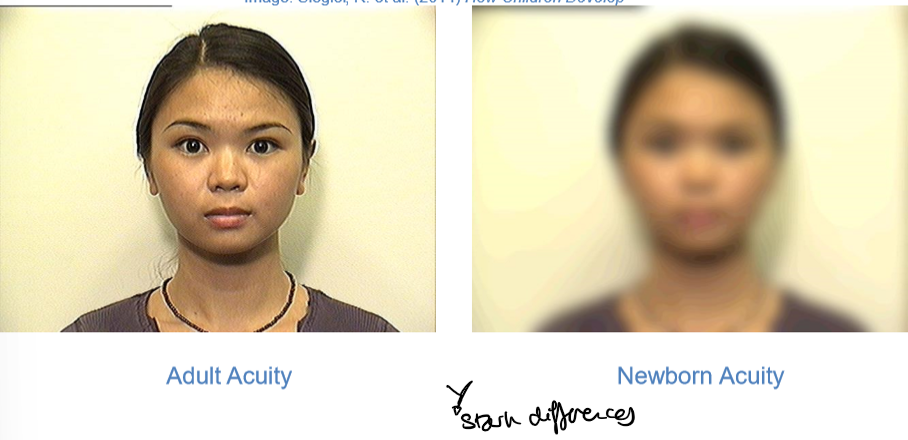 <p>define visual acuity </p>