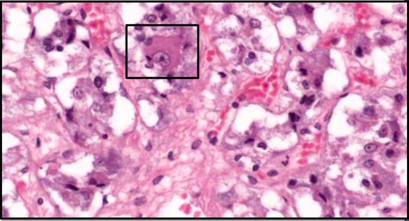 <ul><li><p>Fueron neuronas que perdieron su axon durante el desarrollo embrionario.</p></li><li><p>Mitocondrias con crestas laminares.</p></li><li><p>Gránulos densos rodeados por membrana.</p></li><li><p>Está inervado por el sistema parasimpático y simpático (pre ganglionares).</p></li><li><p>Está en estrecha relación con vénulas y capilares.</p></li><li><p>Se observan por la <span style="color: red"><strong>dicromato de potasio</strong></span>.</p></li></ul><p></p>