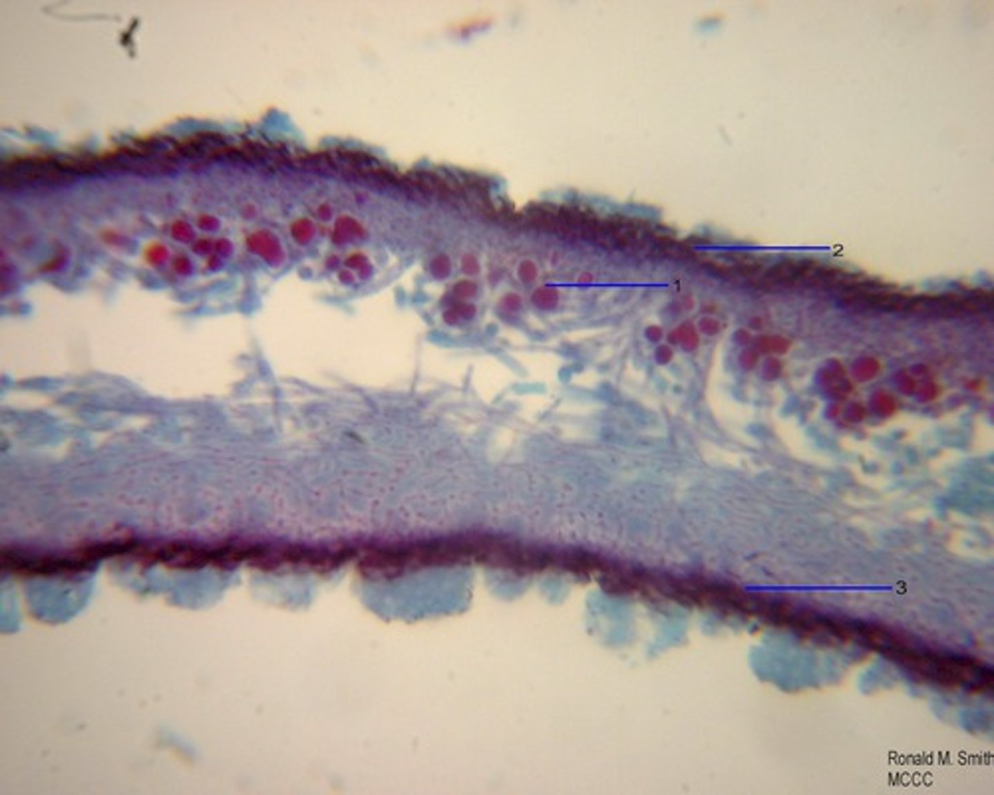 <p>body of fungus</p>