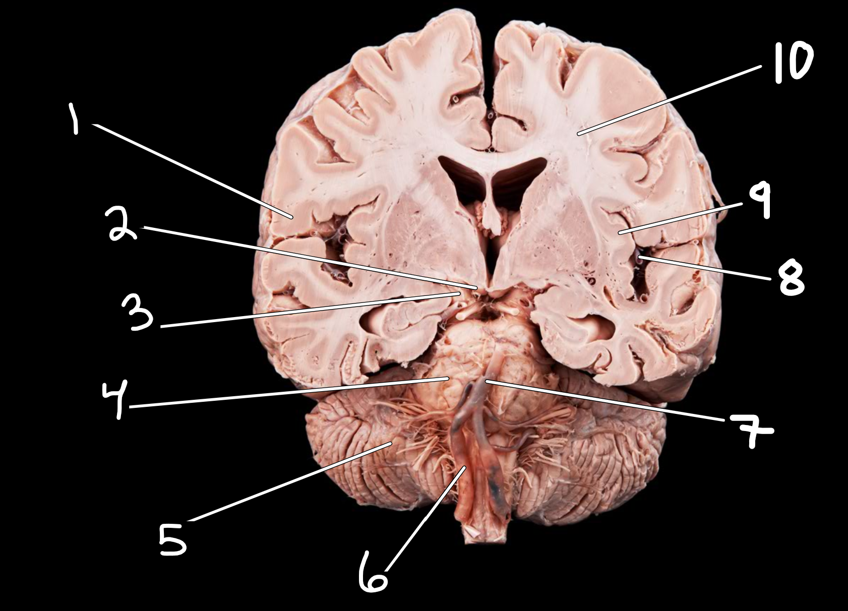 <p>Midsagittal brain: left side </p>
