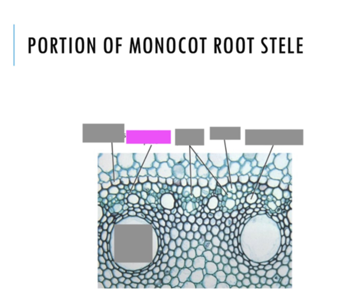 <p>Name the pink highlighted structure.</p>