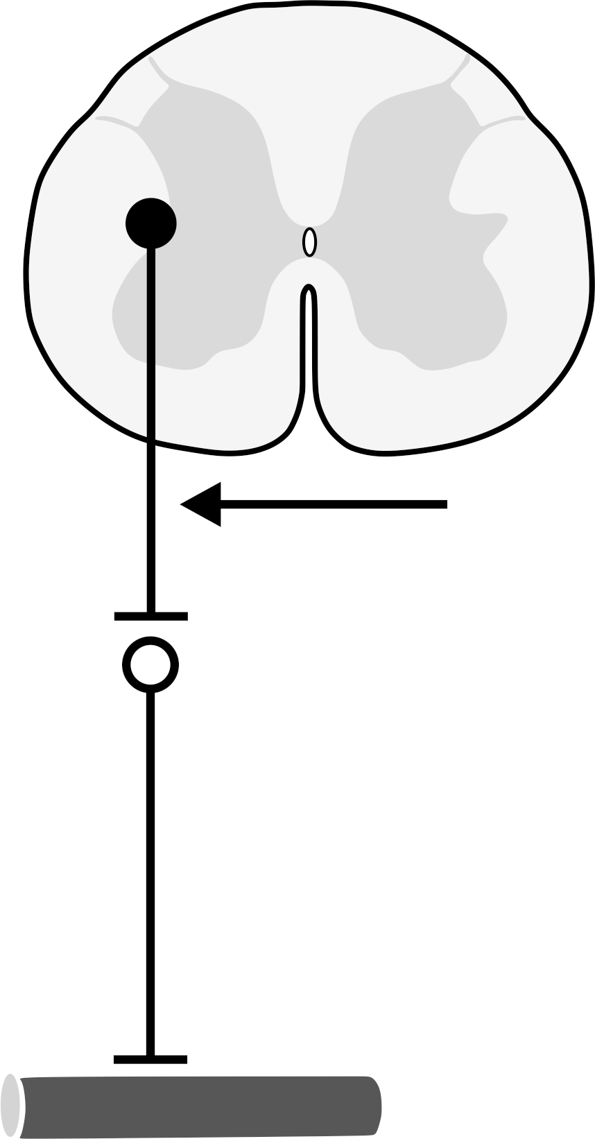 <p>10. The illustration schematically shows an autonomic efferent pathway from the spinal cord to a coronary vessel.</p><p>What is typically the neurotransmitter of the neuron marked by the arrow?</p><p>A. Acetylcholine</p><p>B. Adrenaline</p><p>C. Dopamine</p><p>D. Glutamate</p><p>E. Noradrenaline</p>