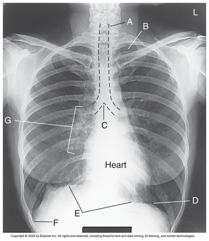<p>What anatomical structure is letter F?</p>