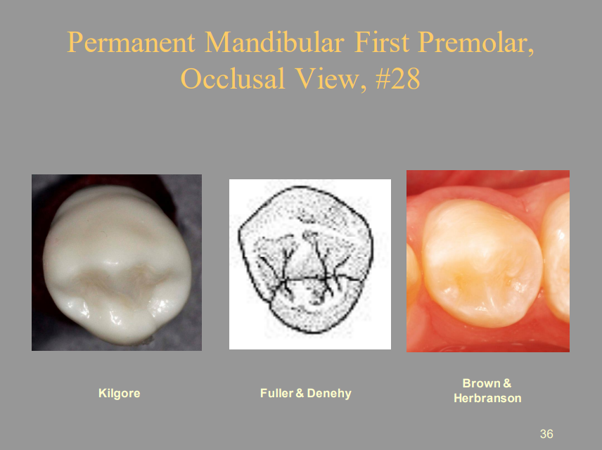 <p>Permanent Mandibular First Premolar, Occlusal View, #28</p>