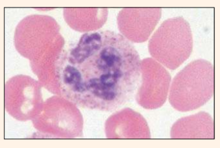 <p>Identify the blood cell</p>