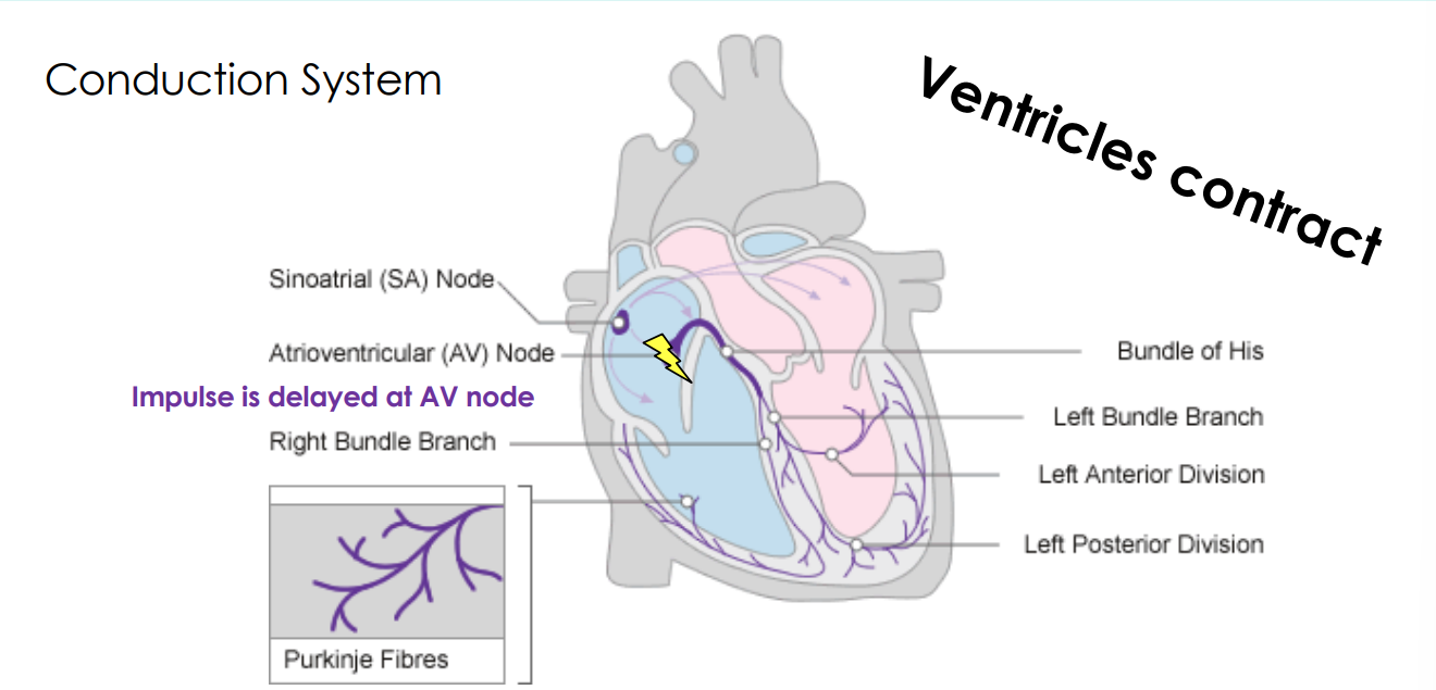 <p>Impulse is delayed at AV node</p>