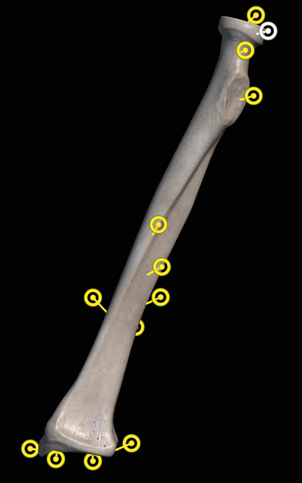 <p>Name structure </p>