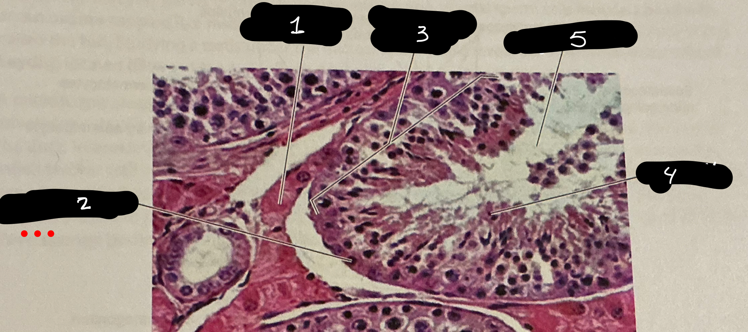 term image
